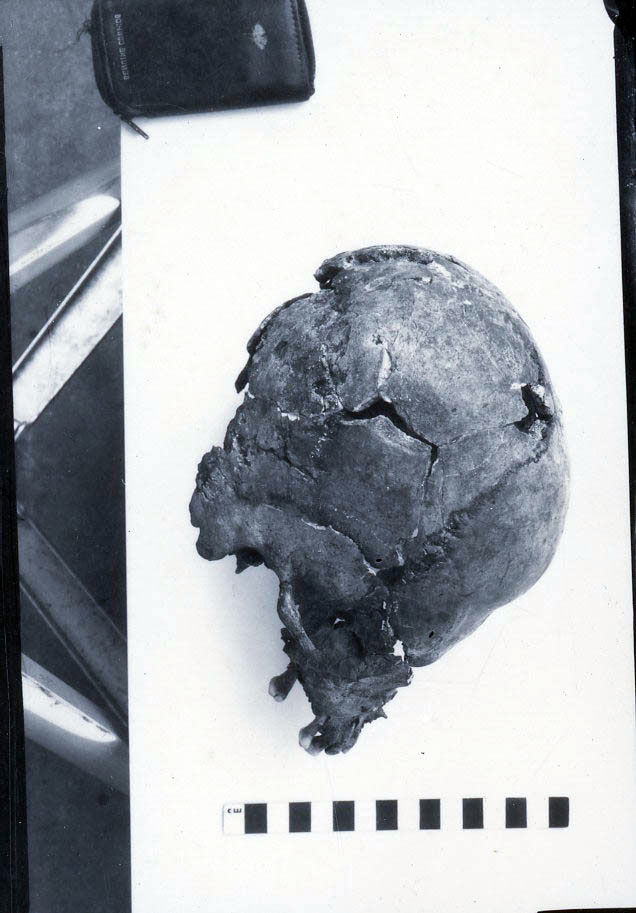 Human Skull