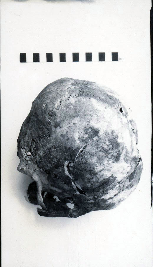 Human Skull
